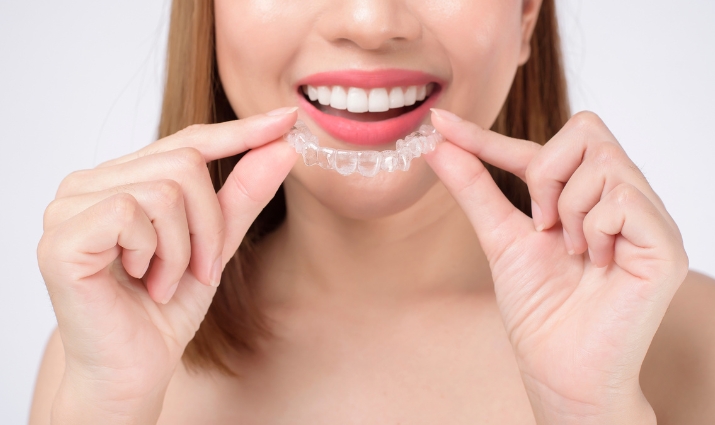 How Crooked Can Your Teeth Be for Invisalign?