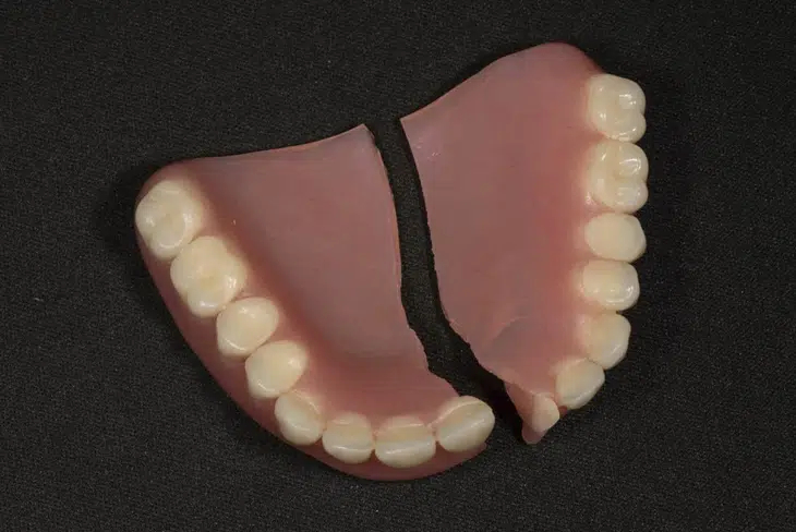 Damage dentures