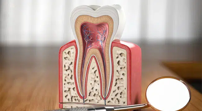 Root canal treatment in Cary NC