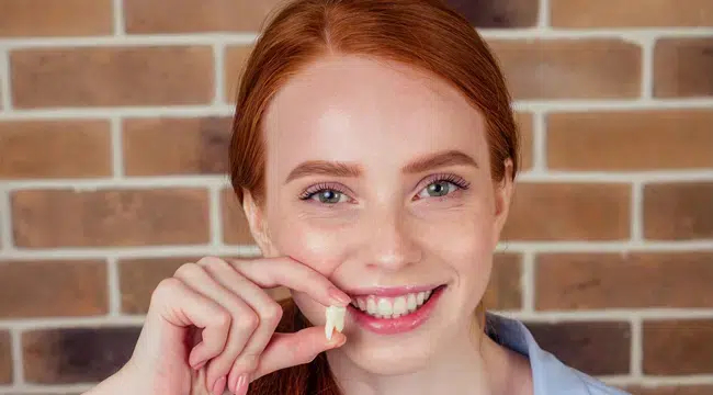 A woman holding her extracted teeth in her hand, representing a recent tooth extraction in Cary.