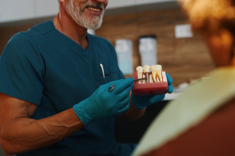 Why Dental Implant is a Long-Term Tooth Replacement Option