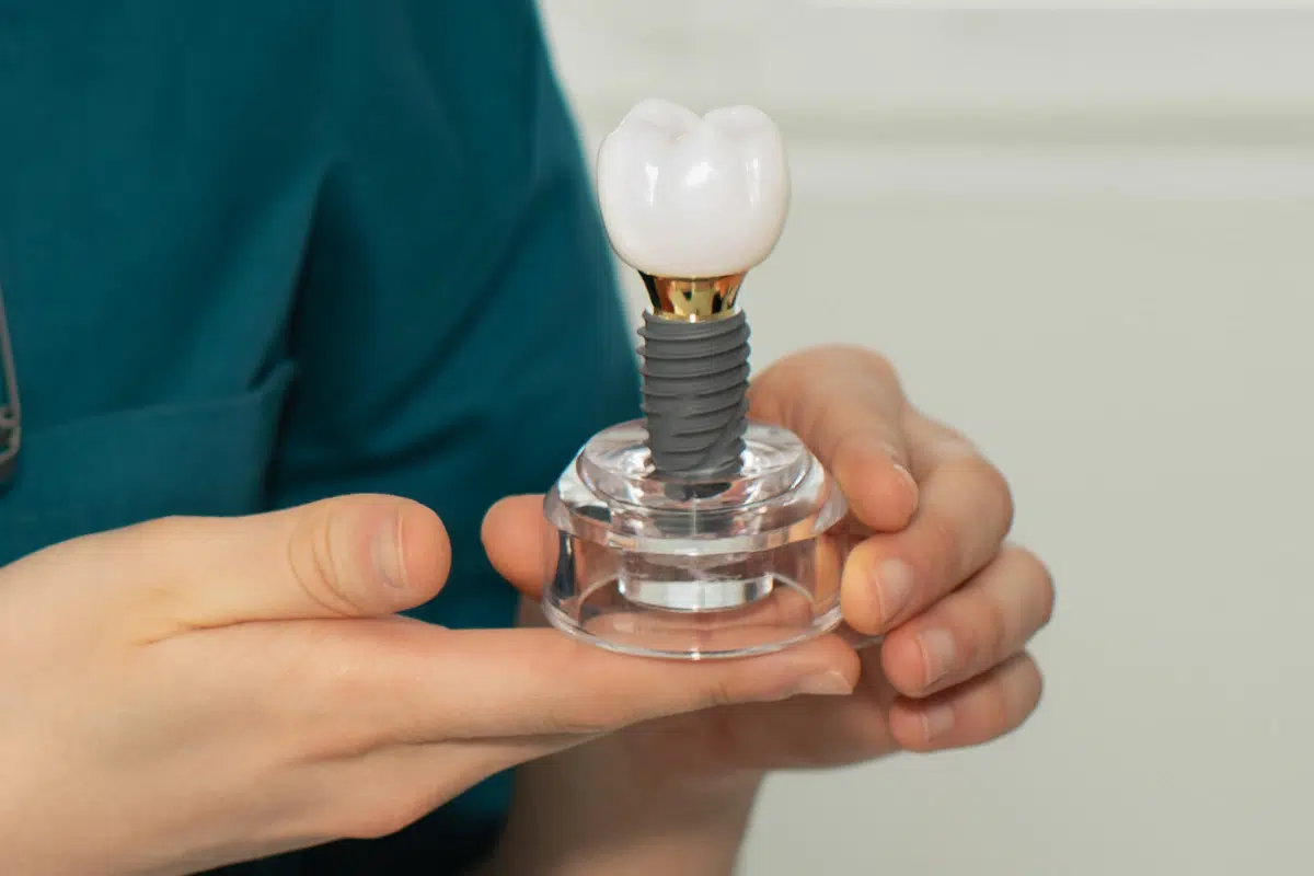 Dental-Implants-What-You-Need-to-Know