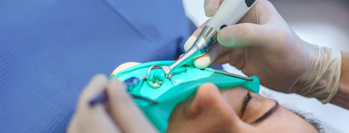 Root Canal Treatment in Cary