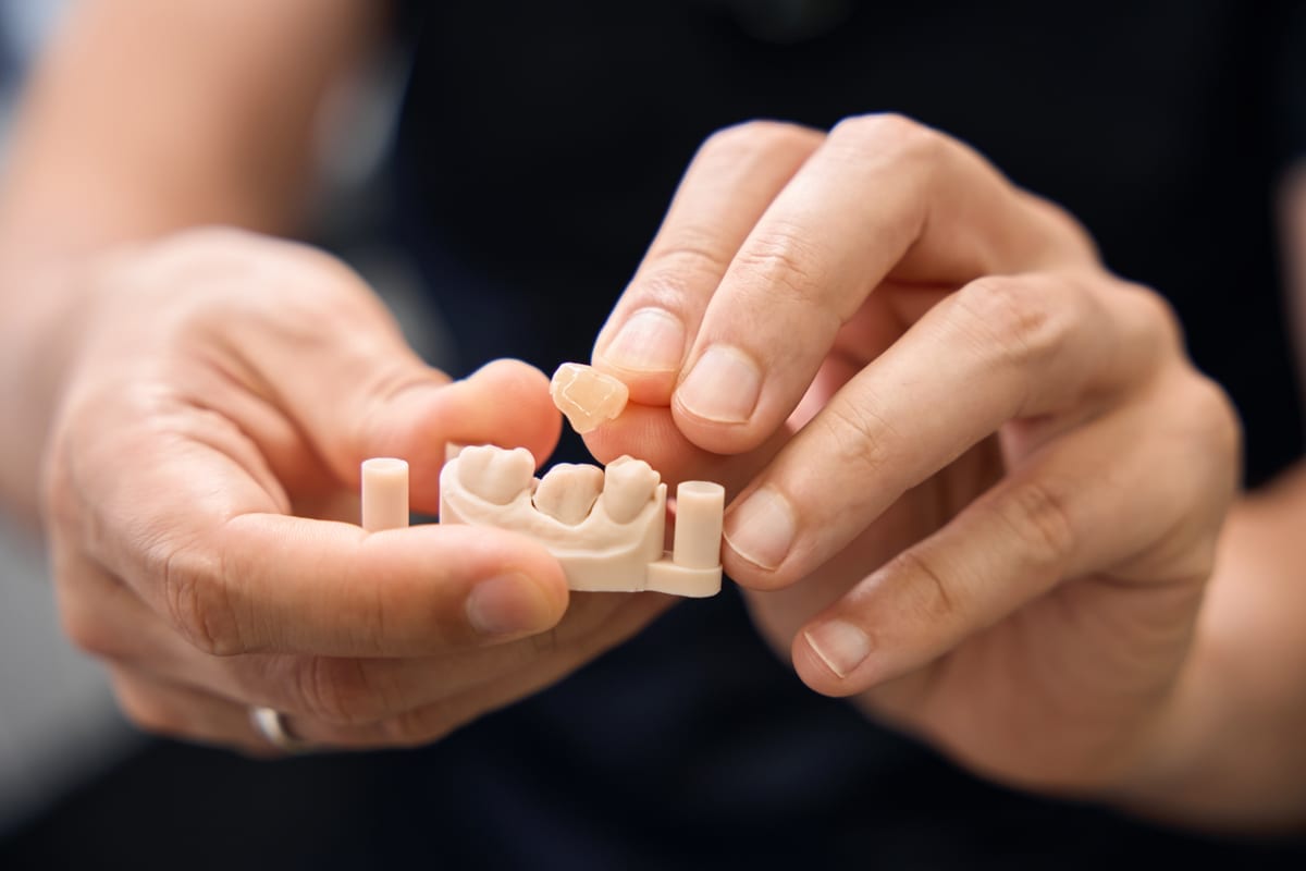 Dental Crowns in Cary